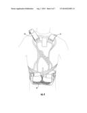 DORSAL LUMBAR EXTENSION BRACE WITH TENSIONING SYSTEM diagram and image