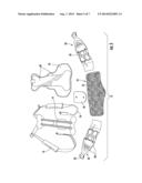 DORSAL LUMBAR EXTENSION BRACE WITH TENSIONING SYSTEM diagram and image