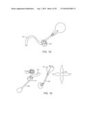 INTRAGASTRIC IMPLANT DEVICES diagram and image