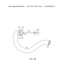 INTRAGASTRIC IMPLANT DEVICES diagram and image