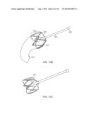 INTRAGASTRIC IMPLANT DEVICES diagram and image