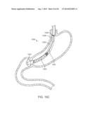 INTRAGASTRIC IMPLANT DEVICES diagram and image