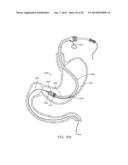 INTRAGASTRIC IMPLANT DEVICES diagram and image