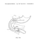 INTRAGASTRIC IMPLANT DEVICES diagram and image