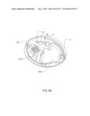 Adhesive and Peripheral Systems and Methods for Medical Devices diagram and image