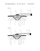 ABSORBENT BODY FOR THE THERAPEUTIC TREATMENT OF A WOUND BY MEANS OF     NEGATIVE PRESSURE diagram and image