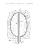 BALLOON IRRIGATION AND CLEANING SYSTEM FOR INTERIOR WALLS OF BODY CAVITIES diagram and image