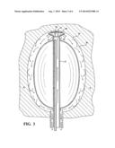 BALLOON IRRIGATION AND CLEANING SYSTEM FOR INTERIOR WALLS OF BODY CAVITIES diagram and image