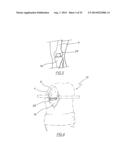 METHOD OF ARTHROPLASTY ON A KNEE JOINT AND APPARATUS FOR USE IN SAME diagram and image