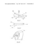 METHOD OF ARTHROPLASTY ON A KNEE JOINT AND APPARATUS FOR USE IN SAME diagram and image