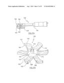 METHOD OF ARTHROPLASTY ON A KNEE JOINT AND APPARATUS FOR USE IN SAME diagram and image