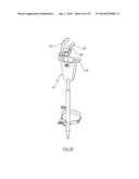 METHOD OF ARTHROPLASTY ON A KNEE JOINT AND APPARATUS FOR USE IN SAME diagram and image