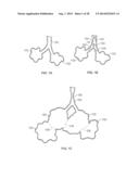 METHODS AND DEVICES FOR DIAGNOSING, MONITORING, OR TREATING MEDICAL     CONDITIONS THROUGH AN OPENING THROUGH AN AIRWAY WALL diagram and image