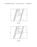 METHODS AND DEVICES FOR DIAGNOSING, MONITORING, OR TREATING MEDICAL     CONDITIONS THROUGH AN OPENING THROUGH AN AIRWAY WALL diagram and image