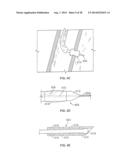 METHODS AND DEVICES FOR DIAGNOSING, MONITORING, OR TREATING MEDICAL     CONDITIONS THROUGH AN OPENING THROUGH AN AIRWAY WALL diagram and image