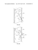 METHODS AND DEVICES FOR DIAGNOSING, MONITORING, OR TREATING MEDICAL     CONDITIONS THROUGH AN OPENING THROUGH AN AIRWAY WALL diagram and image