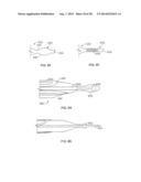 METHODS AND DEVICES FOR DIAGNOSING, MONITORING, OR TREATING MEDICAL     CONDITIONS THROUGH AN OPENING THROUGH AN AIRWAY WALL diagram and image