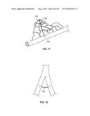 METHODS AND DEVICES FOR DIAGNOSING, MONITORING, OR TREATING MEDICAL     CONDITIONS THROUGH AN OPENING THROUGH AN AIRWAY WALL diagram and image