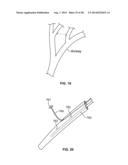 METHODS AND DEVICES FOR DIAGNOSING, MONITORING, OR TREATING MEDICAL     CONDITIONS THROUGH AN OPENING THROUGH AN AIRWAY WALL diagram and image