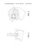 DEVICES AND METHODS FOR FASTENING TISSUE LAYERS diagram and image