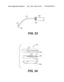 DEVICES AND METHODS FOR FASTENING TISSUE LAYERS diagram and image