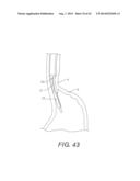 DEVICES AND METHODS FOR FASTENING TISSUE LAYERS diagram and image