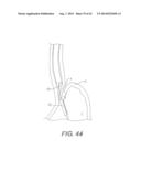 DEVICES AND METHODS FOR FASTENING TISSUE LAYERS diagram and image