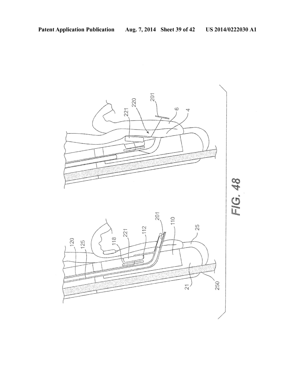 DEVICES AND METHODS FOR FASTENING TISSUE LAYERS - diagram, schematic, and image 40