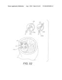 DEVICES AND METHODS FOR FASTENING TISSUE LAYERS diagram and image