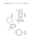 Tissue-Removing Catheter Including Operational Control Mechanism diagram and image