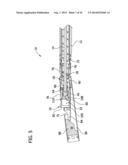 Tissue-Removing Catheter for Body Lumen diagram and image