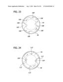 Tissue-Removing Catheter for Body Lumen diagram and image