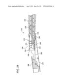 Tissue-Removing Catheter for Body Lumen diagram and image