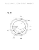 Tissue-Removing Catheter for Body Lumen diagram and image