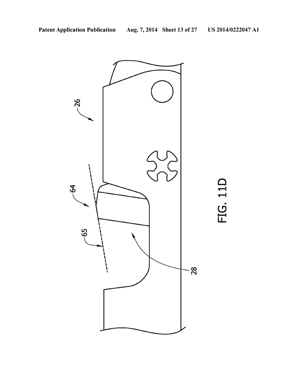 Tissue-Removing Catheter Including Urging Mechanism - diagram, schematic, and image 14