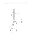 Tissue-Removing Catheter Including Urging Mechanism diagram and image