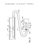 Tissue-Removing Catheter Including Urging Mechanism diagram and image