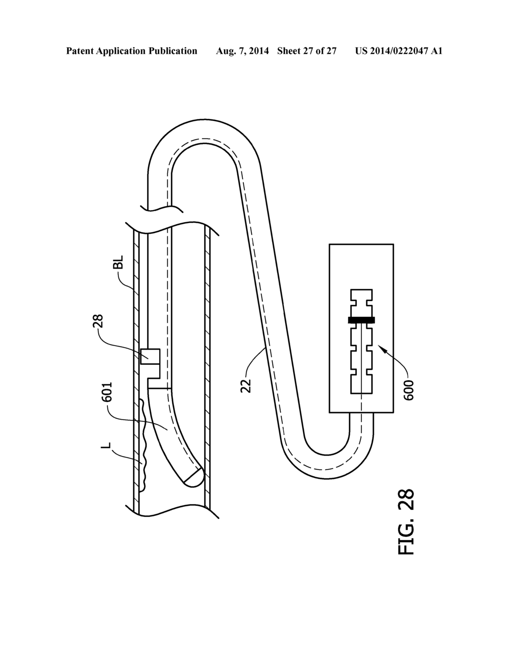 Tissue-Removing Catheter Including Urging Mechanism - diagram, schematic, and image 28