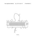 MEDICAL DEVICES INCLUDING METALLIC FILMS AND METHODS FOR MAKING SAME diagram and image