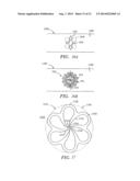 CLOSURE DEVICE AND METHODS FOR MAKING AND USING THEM diagram and image