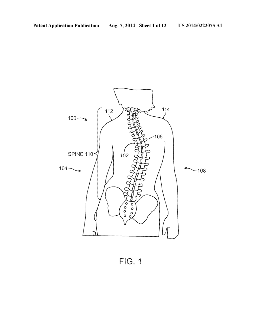 MAINTENANCE FEATURE IN MAGNETIC IMPLANT - diagram, schematic, and image 02