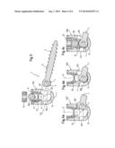 BONE ANCHORING DEVICE diagram and image