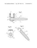 BONE ANCHORING DEVICE diagram and image