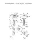 STABILIZATION DEVICE FOR BONES COMPRISING A SPRING ELEMENT AND     MANUFACTURING METHOD FOR SAID SPRING ELEMENT diagram and image