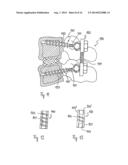 STABILIZATION DEVICE FOR BONES COMPRISING A SPRING ELEMENT AND     MANUFACTURING METHOD FOR SAID SPRING ELEMENT diagram and image