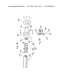 STABILIZATION DEVICE FOR BONES COMPRISING A SPRING ELEMENT AND     MANUFACTURING METHOD FOR SAID SPRING ELEMENT diagram and image