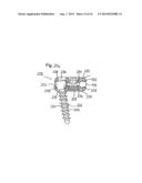 STABILIZATION DEVICE FOR BONES COMPRISING A SPRING ELEMENT AND     MANUFACTURING METHOD FOR SAID SPRING ELEMENT diagram and image