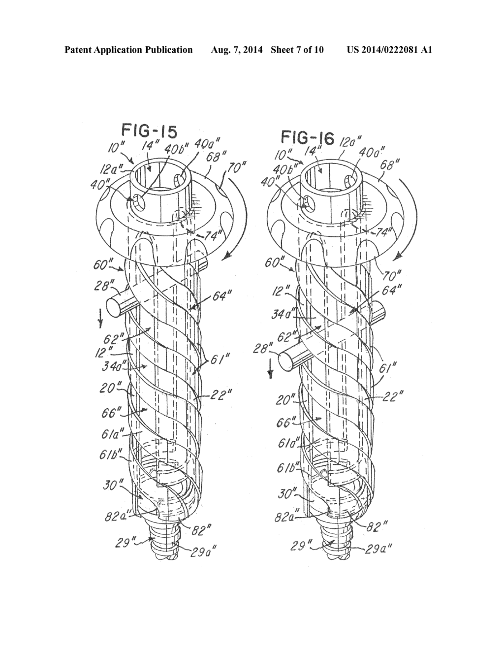 RETRACTION TUBE FOR USE WITH CAPLESS PEDICLE SCREW - diagram, schematic, and image 08