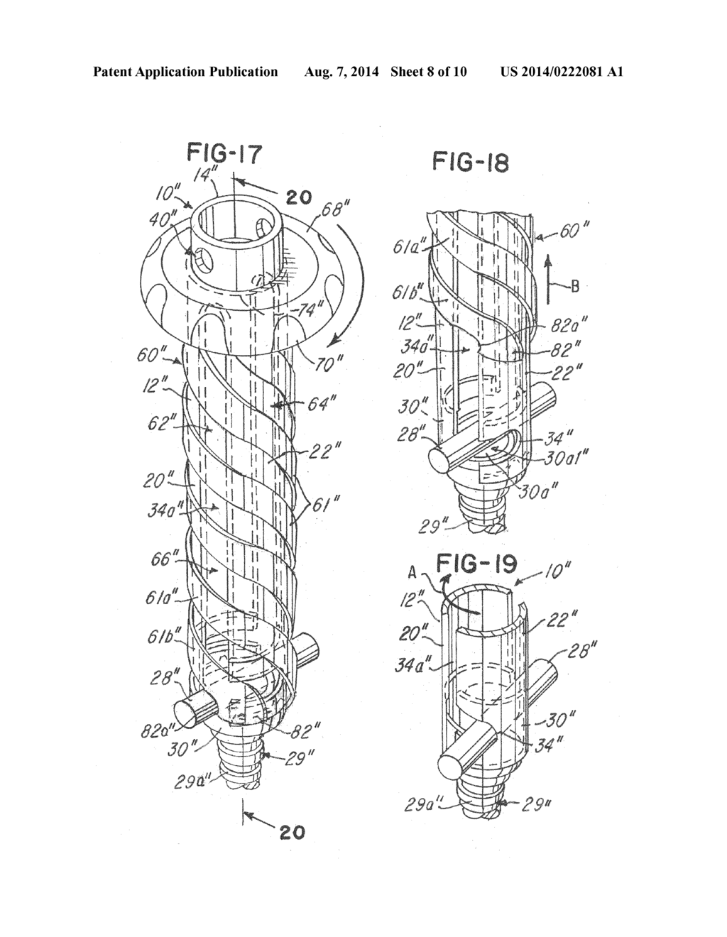 RETRACTION TUBE FOR USE WITH CAPLESS PEDICLE SCREW - diagram, schematic, and image 09