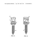 Polyaxial Screw diagram and image